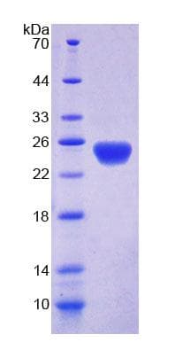 Human DLG5 Protein (Recombinant His-T7, N-terminus)