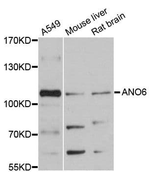 ANO6 Antibody