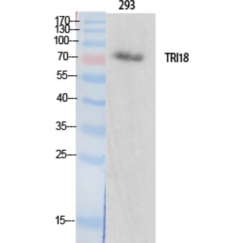 MID1 Antibody (40-120 aa, N-terminal)