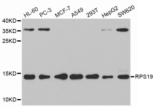 Polyclonal Rabbit anti-Human RPS19 / Ribosomal Protein S19 Antibody (IHC, WB)