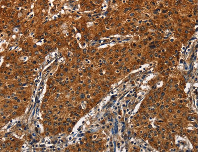 Polyclonal Rabbit anti-Human CATSPER4 Antibody (IHC)