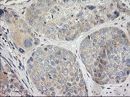 ITFG2 Antibody (clone OTI3C4)