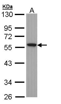 Polyclonal Rabbit anti-Human Alpha Tubulin Antibody (aa118-365, IHC, WB)
