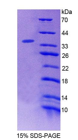 Human BIN2 Protein (Recombinant His-T7)
