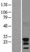 AKIP1 / BCA3 Protein (Over-Expression Lysate Myc-DDK (Flag))