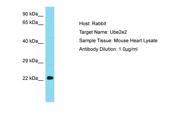 Polyclonal Rabbit anti-Mouse UBE2E2 / UBCH8 Antibody (N-Terminus, WB)