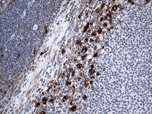 CTSL / Cathepsin L Antibody (aa114-333, clone OTI5C8)