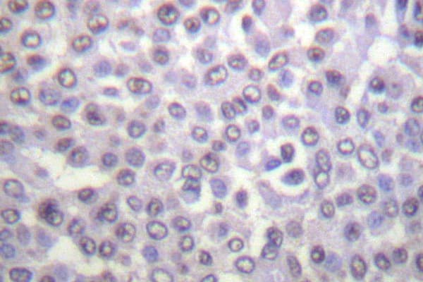 Histone H4 Antibody (Lys12)