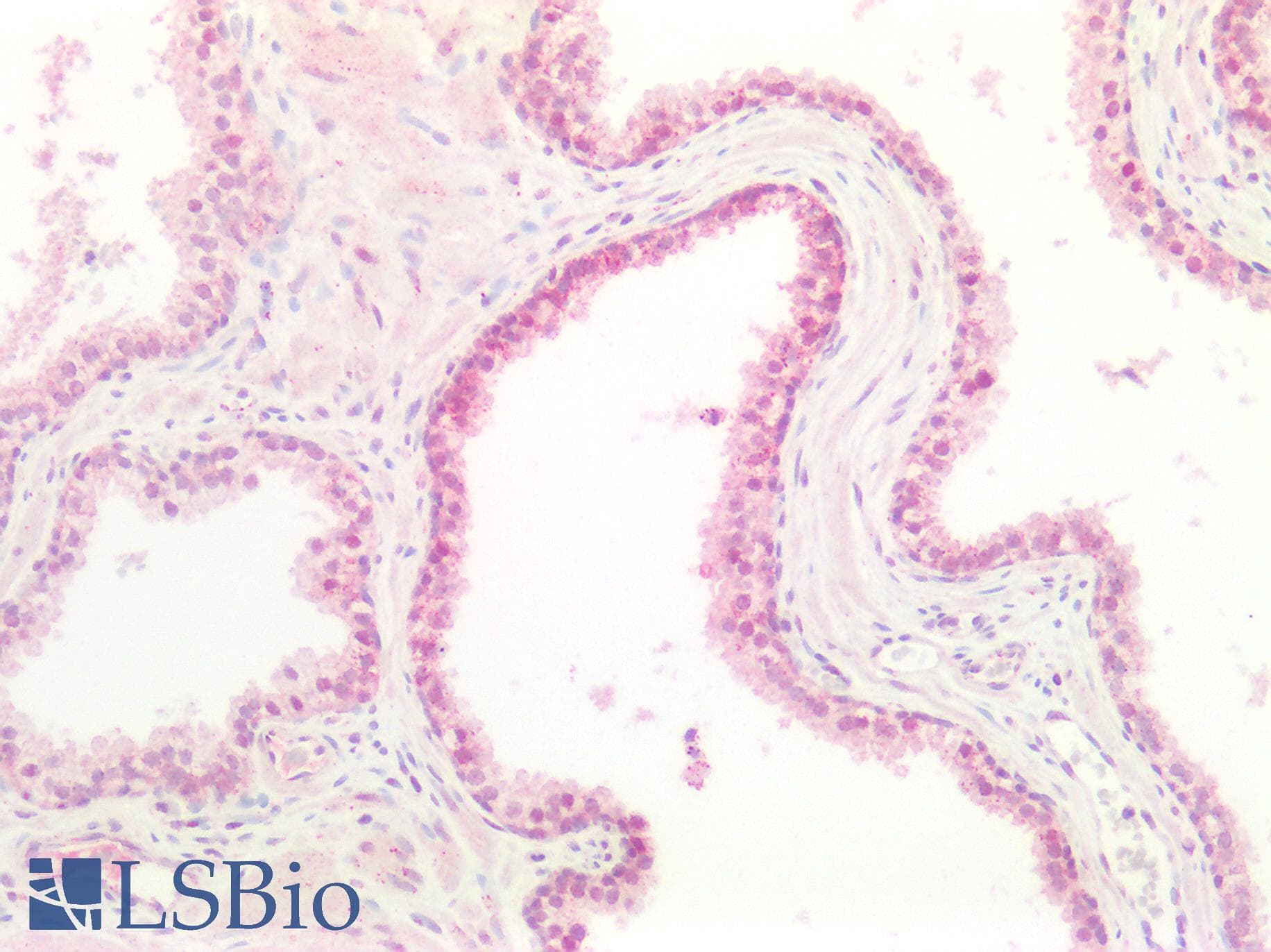 IHC-plus™ ADAM10 Antibody