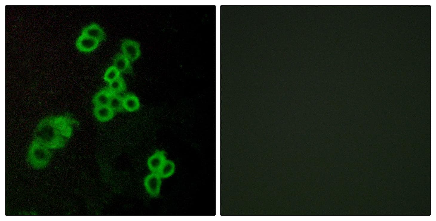 Polyclonal Rabbit anti-Human LPAR1 / LPA1 / EDG2 Antibody (IHC, IF, WB)