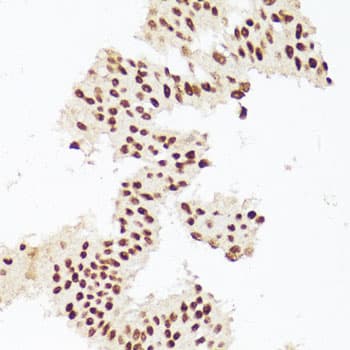Polyclonal Rabbit anti-Human ESRRA / ERR Alpha Antibody (IHC, WB)