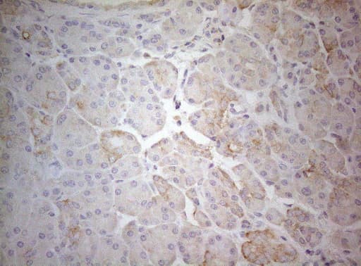 TWF1 / PTK9 Antibody (aa140-384, clone OTI5C12)