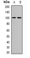 ASAH2 Antibody
