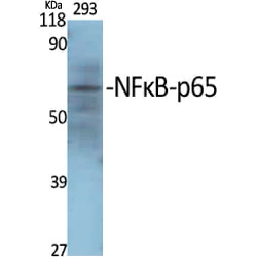 RELA / NFKB p65 Antibody (250-330 aa)