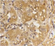 Polyclonal Rabbit anti-Human BCL2L11 / BIM Antibody (IHC, IF, WB)