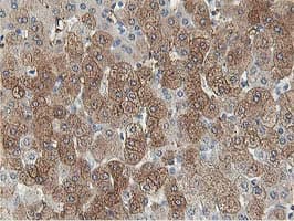 Monoclonal Mouse anti-Human ALDOB Antibody (clone OTI3C6, IHC, WB)