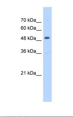 Polyclonal Rabbit anti-Human HMGCS2 / HMG-CoA Synthase 2 Antibody (aa51-100, IHC, WB)
