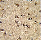 RAIN / RASIP1 Antibody (aa651-678)