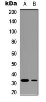PPP1R1B / DARPP-32 Antibody (phospho-Thr75)
