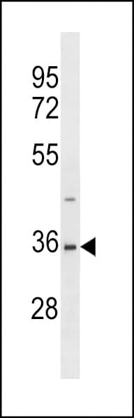 Polyclonal Rabbit anti-Human SAE1 Antibody (aa300-329, IHC, WB)