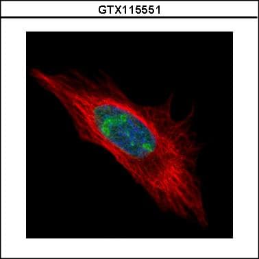 DDX56 Antibody (aa201-393)