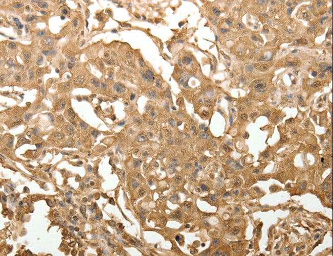TXN / Thioredoxin / TRX Antibody