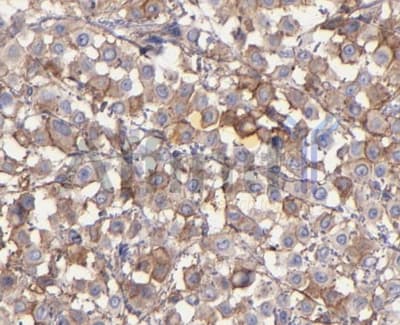 ITGAV/Integrin Alpha V/CD51 Antibody