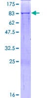 Human SARS2 / SYS Protein (Recombinant GST)