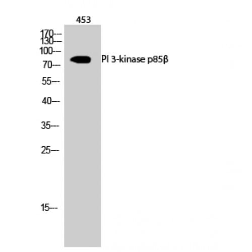 Polyclonal Rabbit anti-Human PIK3R2 / p85 Beta Antibody (WB)