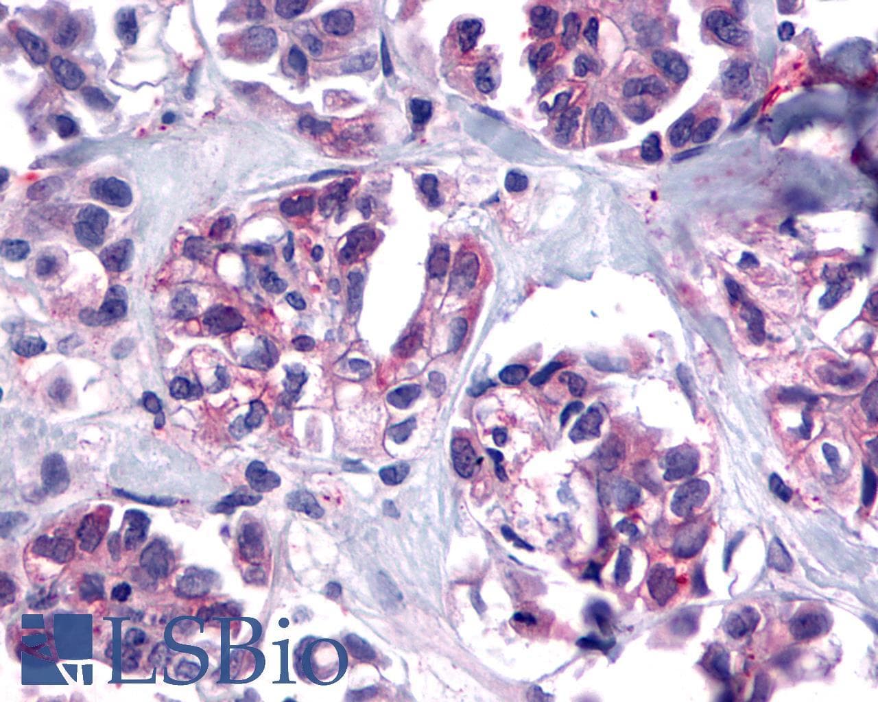 PathPlus™ TACR2 / NK2R Antibody (C-Terminus)