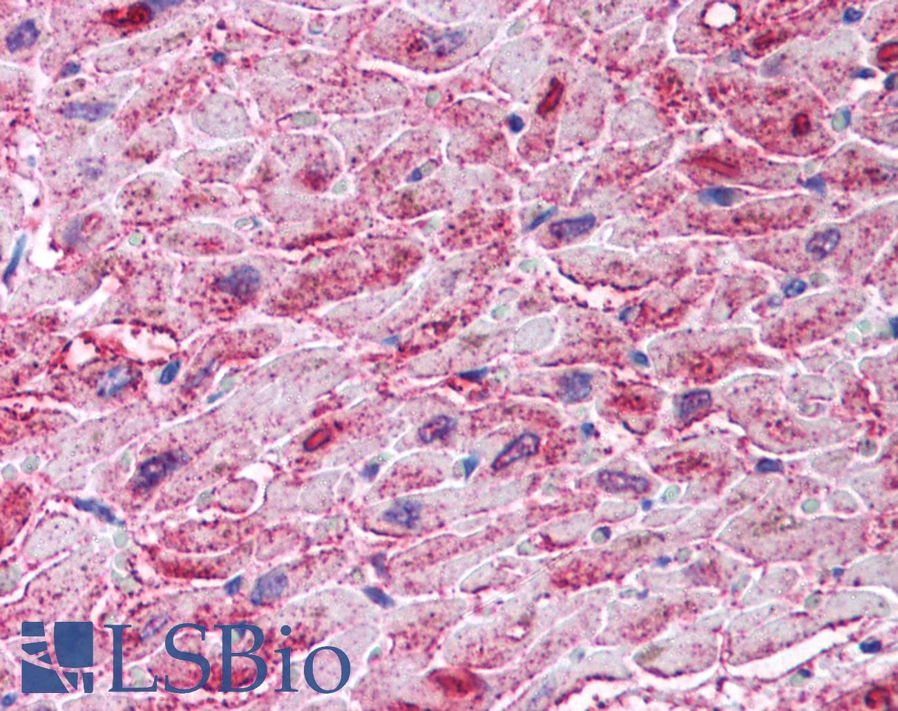 IHC-plus™ Polyclonal Chicken anti-Human IKBKB / IKK2 / IKK Beta Antibody (aa310-376, IHC, WB)