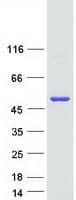Human CHKB / CHKL Protein (Recombinant Myc-DDK (Flag))