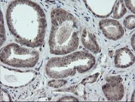 ESRRG / ERR Gamma Antibody (aa24-263, clone OTI1E5)
