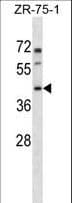 PANX3 / Pannexin 3 Antibody (aa3-31)