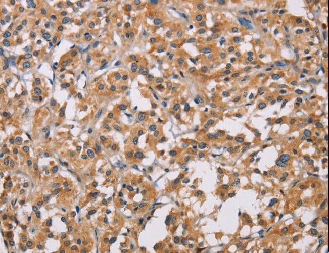 Polyclonal Rabbit anti-Human PD-L2 / PDCD1LG2 / CD273 Antibody (IHC)