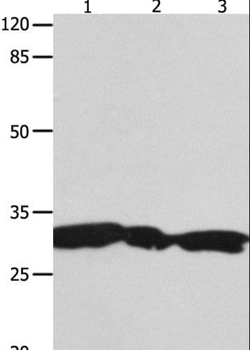 Polyclonal Rabbit anti-Human YWHAG / 14-3-3 Gamma Antibody (IHC, WB)