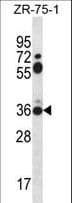 Polyclonal Rabbit anti-Human STX2 / Syntaxin 2 Antibody (aa123-152, IHC, WB)