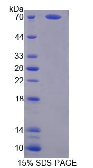 Human PSMD4 / RPN10 Protein (Recombinant His-GST)