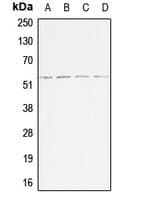 IHC-plus™ ACVR1B / ALK4 Antibody (Internal)