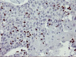 PADI4 / PAD4 Antibody (clone OTI5E7)