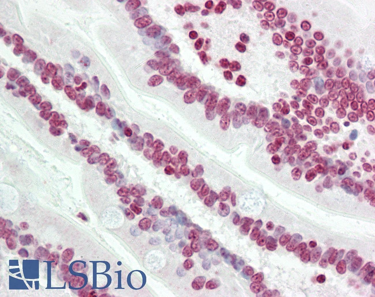 IHC-plus™ Polyclonal Rabbit anti-Human GRG4 / TLE4 Antibody (N-Terminus, IHC, WB)