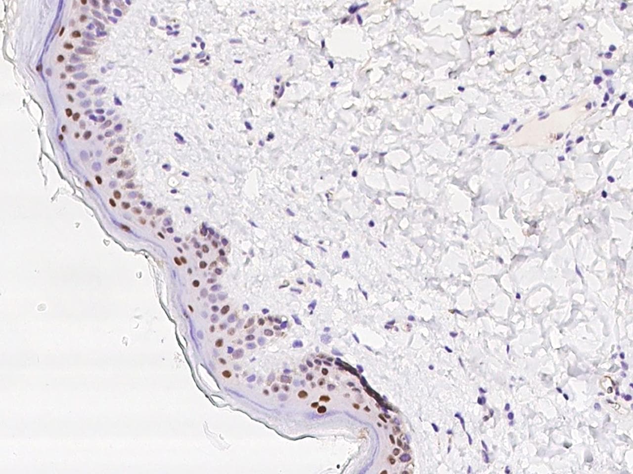 CASZ1 Antibody