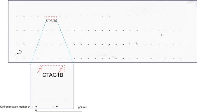 CTAG1B / NY-ESO-1 Antibody (clone UMAB72, Carrier-free)