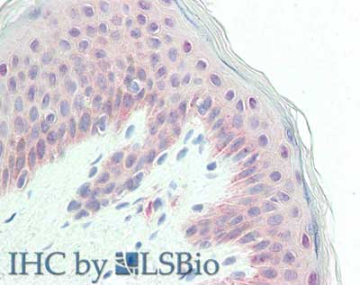 GPC1 / Glypican Antibody (Internal)