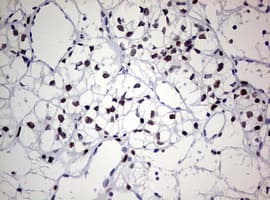 ZEB2 / SIP-1 Antibody (aa1-350, clone OTI1E12)