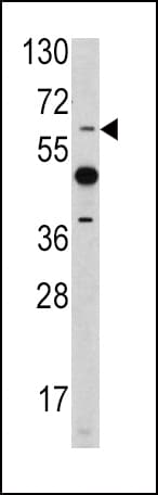 PEA3 / ETV4 Antibody (aa419-447)