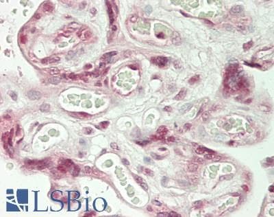 IHC-plus™ Polyclonal Rabbit anti-Human NARG1 / NAA15 Antibody (aa816-866, IHC, IF, WB)