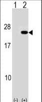 Polyclonal Rabbit anti-Human PAIP2 Antibody (aa7-34, WB)