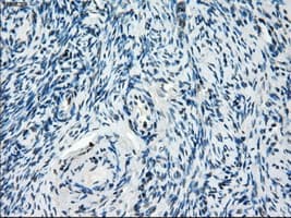 Monoclonal Mouse anti-Human ZFP36 / Tristetraprolin Antibody (clone OTI8B5, IHC, IF, WB)