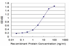 DES / Desmin Antibody (clone 1D12)